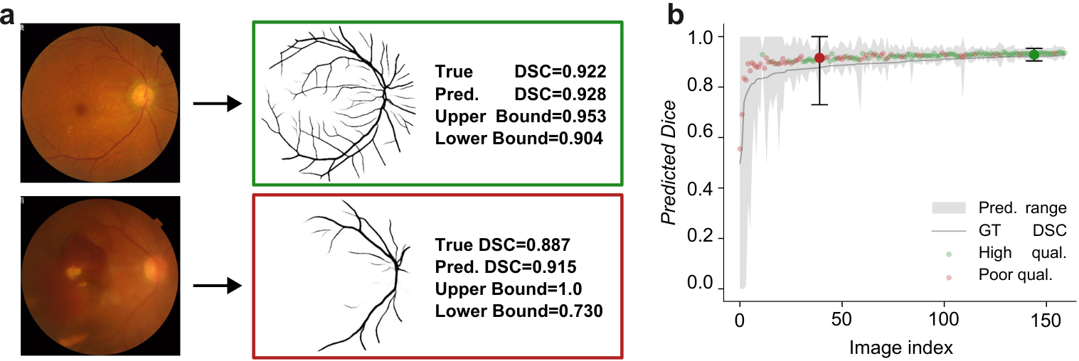 Figure for Conformal Performance Range Prediction for Segmentation Output Quality Control